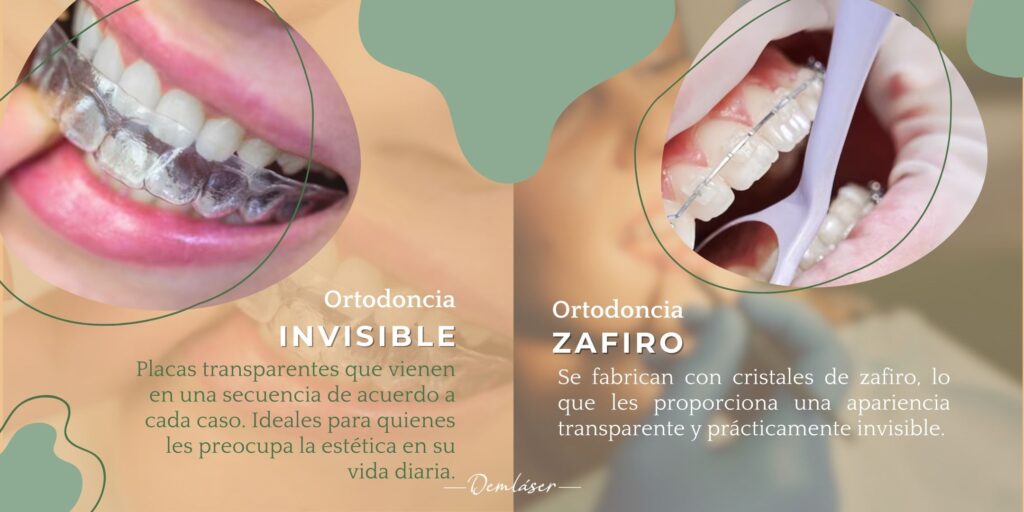 Ortodoncia invisible Ortodoncia zafiro