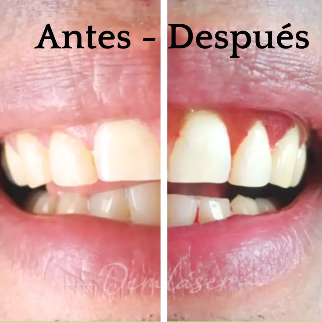 odontología_estética_belleza_salud_bienestar_sonrisa_tratamineto_blanqueamiento_ortodoncia