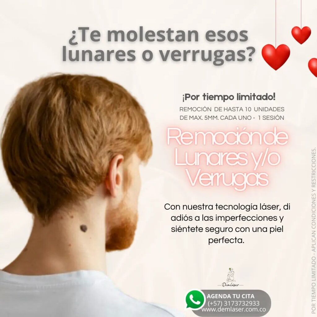 remoción_lunares_verrugas_láser_coporal_facial_axilas_bikini_belleza_salud_bienestar_amigas_promoción_amor_amistad